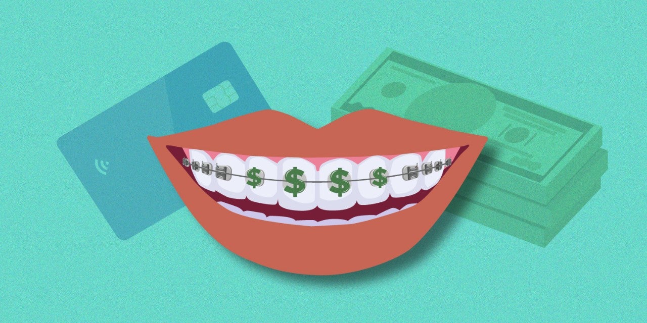 braces on teeth, with payment options in the background